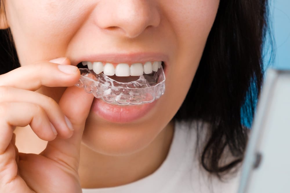 person-inserting-clear-dental-aligner-tray