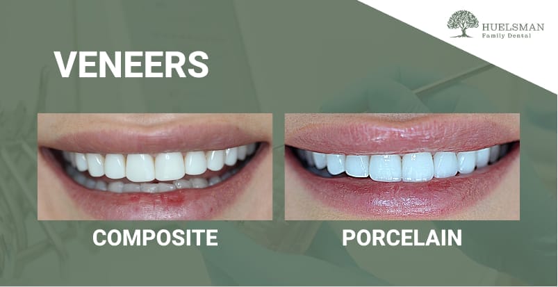 comparison between composite and porcelain denture
