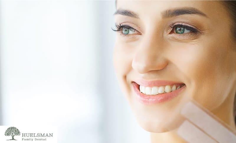 woman showing her teeth smiling