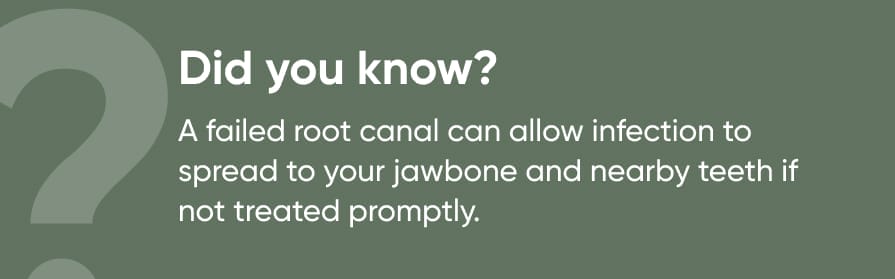 image text: Did you know? A failed root canal can allow infection to spread to your jawbone and nearby teeth if not treated promptly.